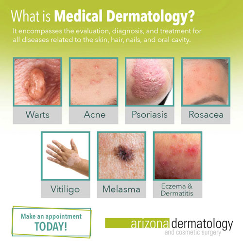 What is medical dermatology?