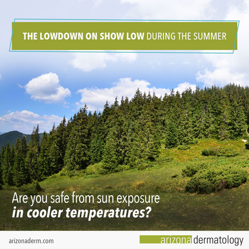 Find out if you are safe from sun exposure in cooler temperatures.