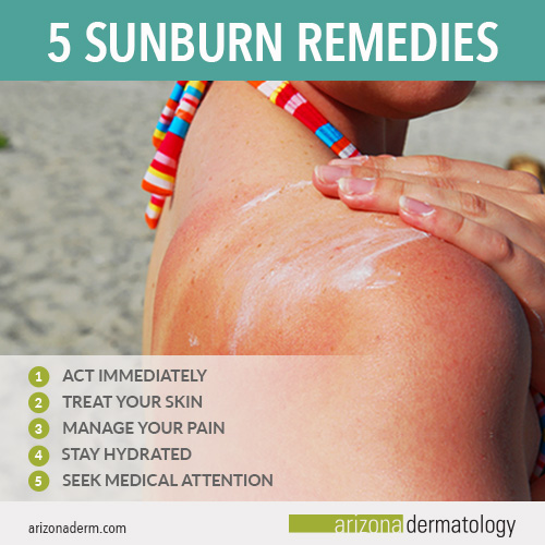 5 Ways To Treat Your Sunburn Arizona Dermatology