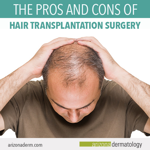 The pros and cons of hair transplantation surgery