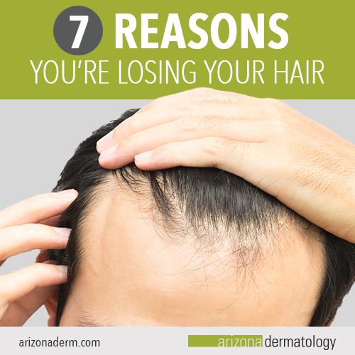 7 reasons you're losing your hair