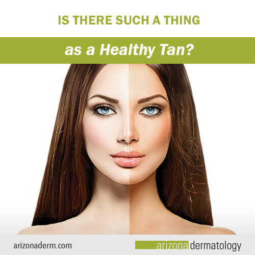Is There Such a Thing as a Healthy Tan?