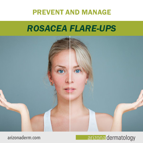 Prevent and Manage Rosacea Flare-ups